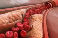 Cholesterol