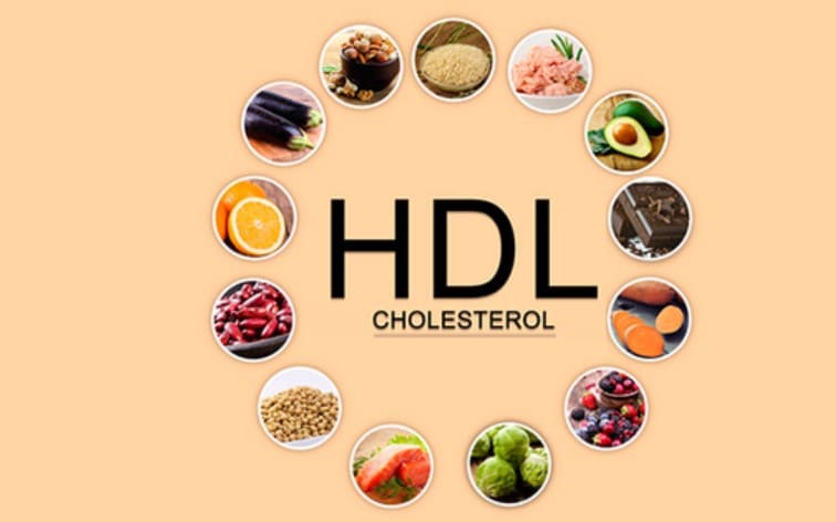 HDL Cholesterol